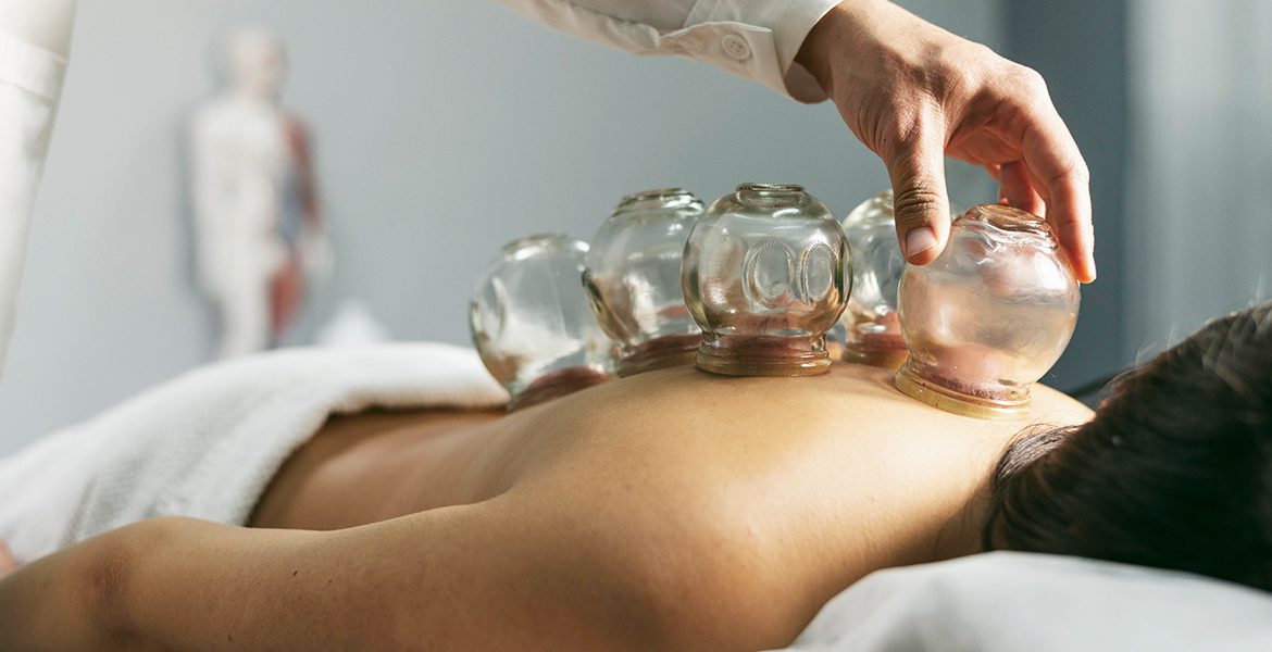 ¿En qué consiste la terapia con ventosas?